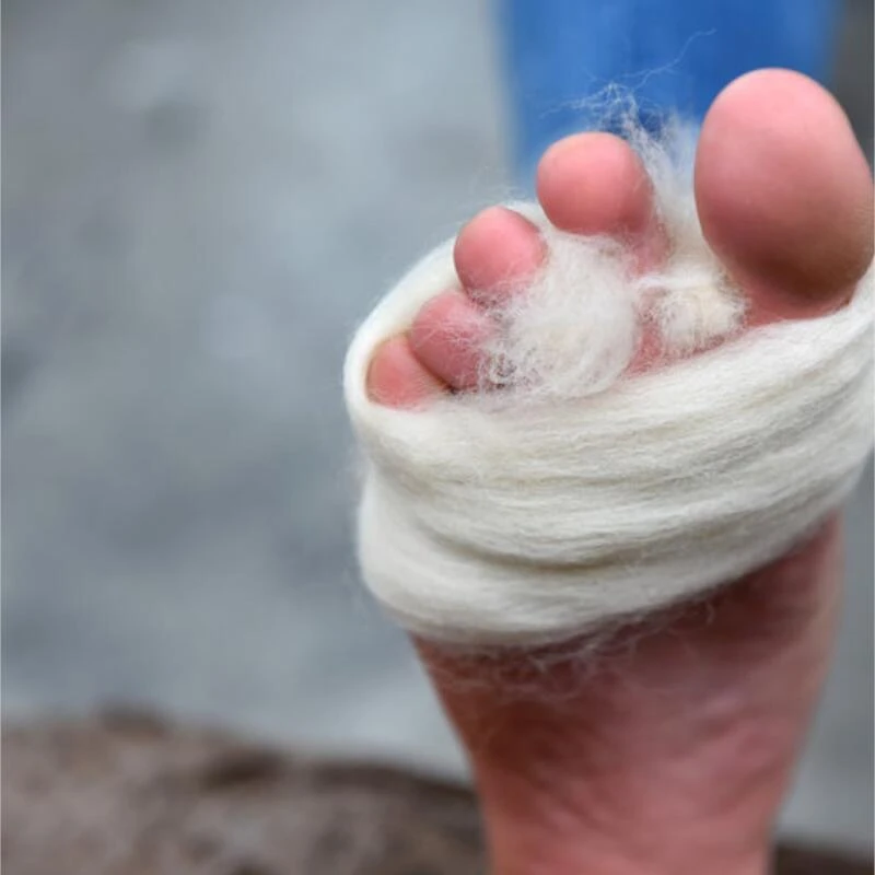 Merino Anti-Druk Wol – 50 Gram - Extra Verlichting En Tegen Blaarvorming 2 Merino Anti-Druk Wol – 50 Gram - Extra Verlichting En Tegen Blaarvorming - Afbeelding 2